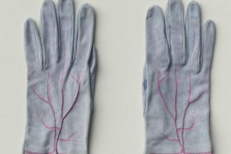 Digitalisierung der Werksammlung Meret Oppenheim — Kunstmuseum Bern, recom art care Berlin